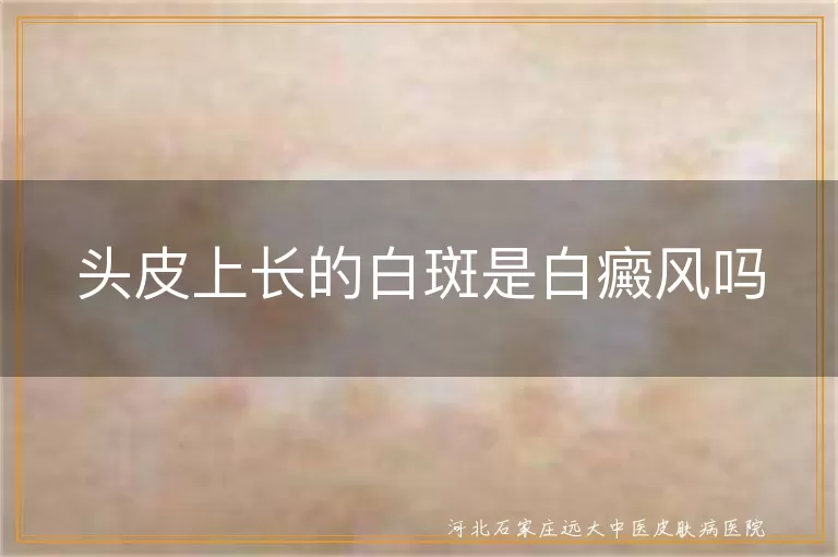 头皮上长的白斑是白癜风吗