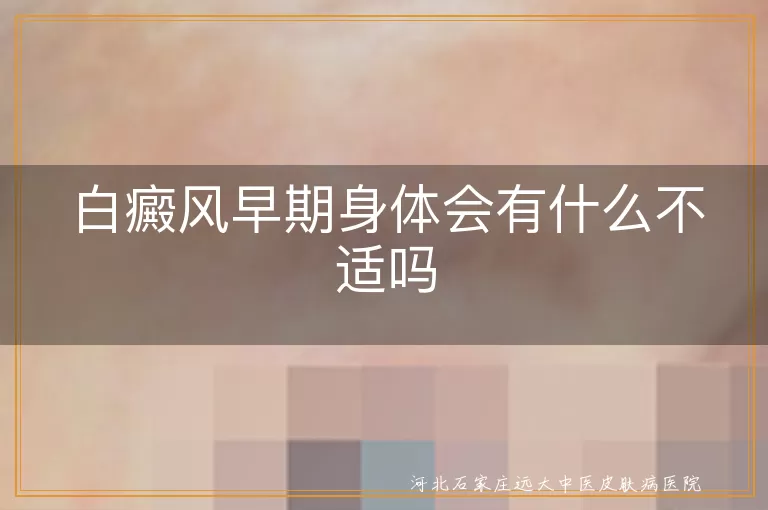 白癜风早期身体会有什么不适吗
