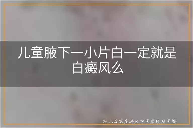 儿童腋下白斑不一定白癜风,小朋友腋下白块别慌查白斑,腋下淡白斑鉴别白癜风