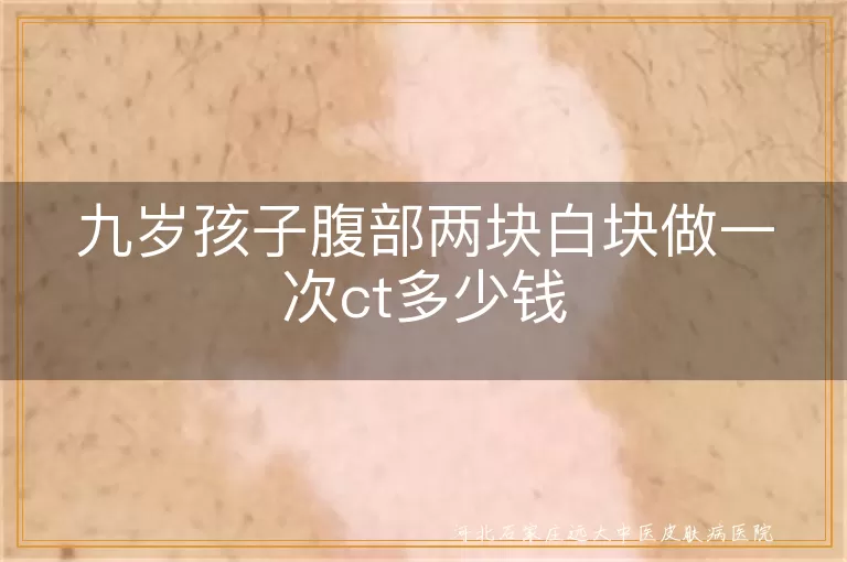 九岁孩子腹部两块白块做一次ct多少钱