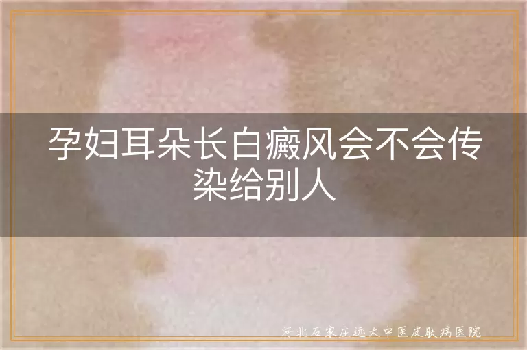 孕妇耳朵长白癜风会不会传染给别人