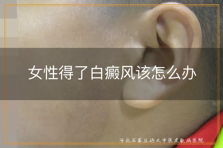 女性白斑日常护理要点,白癜风女生心理调节方法,女性面部白斑遮瑕技巧
