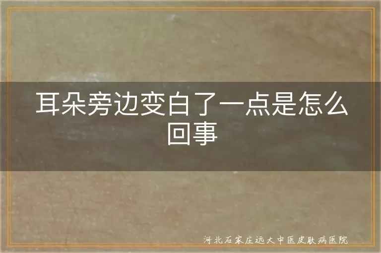 耳朵旁现白斑警惕白癜风,耳侧片状白斑会是白癜风吗,白斑悄悄爬上耳廓可能是白癜风信号