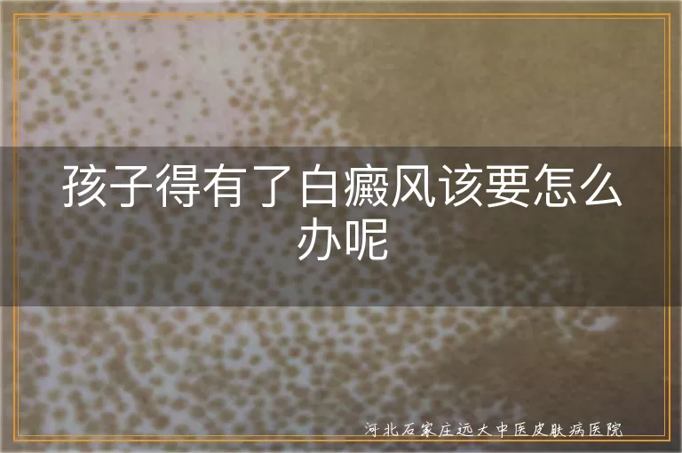 孩子白癜风初期怎么判断,儿童白斑扩散怎么控制,小孩白癜风日常护理要点