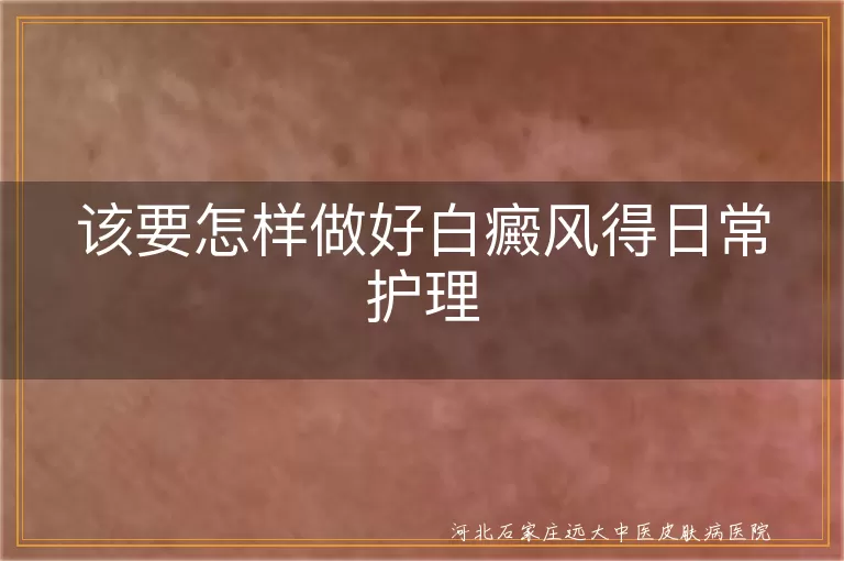 白癜风日常护理小方法,白斑皮肤居家保养要点,白癜风换季防扩散技巧