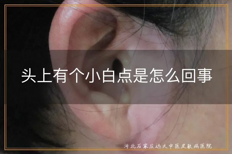 头上有个小白点是怎么回事