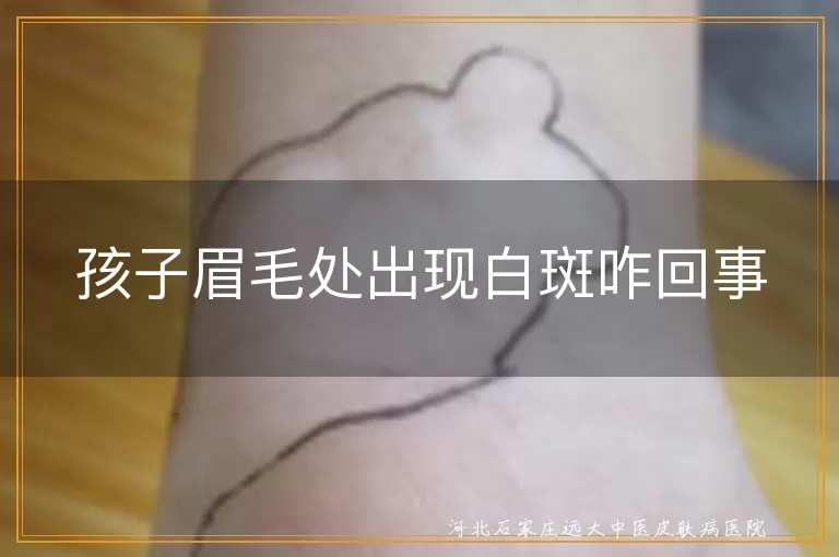 孩子眉毛处出现白斑咋回事
