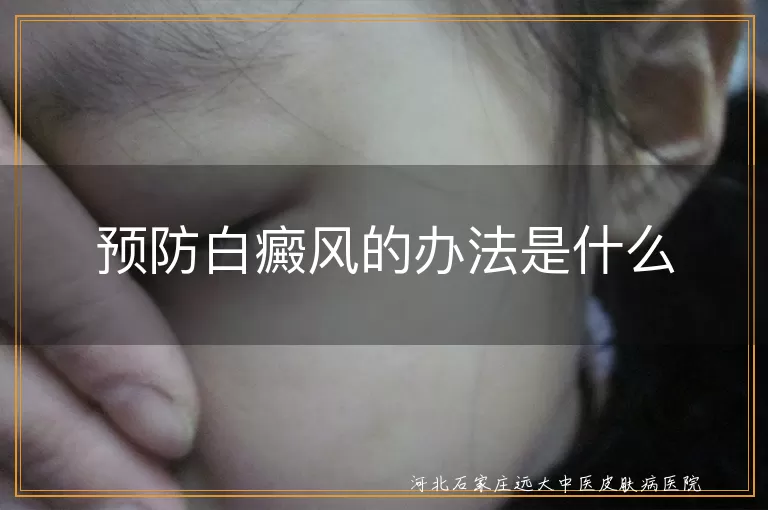 预防白癜风的办法是什么