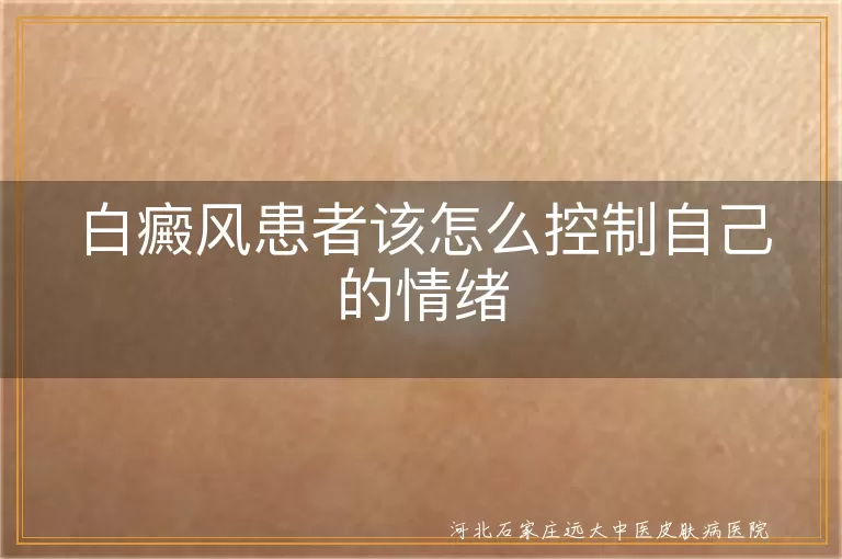 白癜风患者该怎么控制自己的情绪