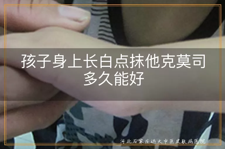孩子身上长白点抹他克莫司多久能好