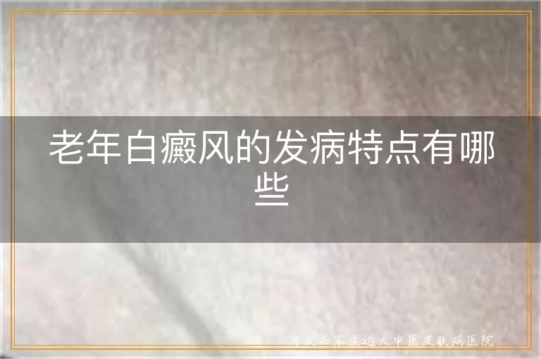 老年白癜风的发病特点有哪些