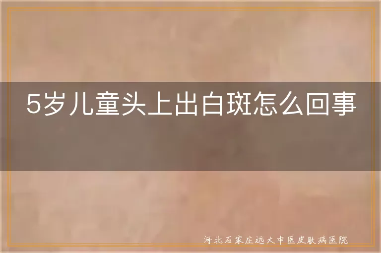 5岁儿童头上出白斑怎么回事