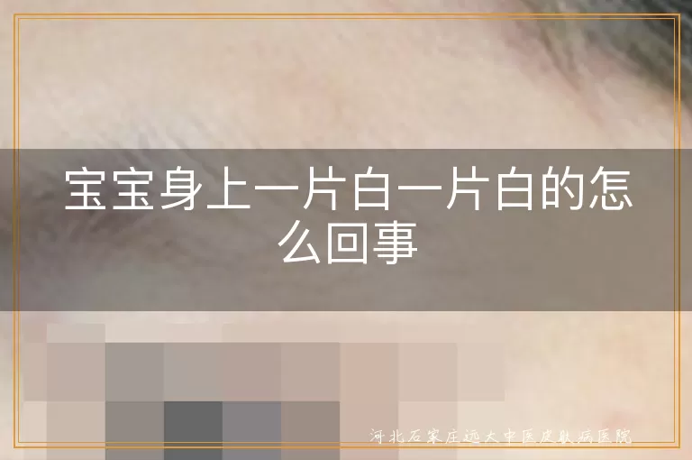 宝宝皮肤白斑是怎么回事,婴儿白癜风早期表现,宝宝身上白斑是不是白癜风