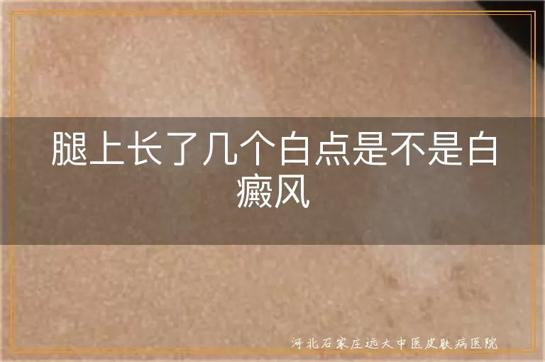 腿上白斑是不是白癜风,小腿白点会不会是白癜风,腿部白癜风早期识别