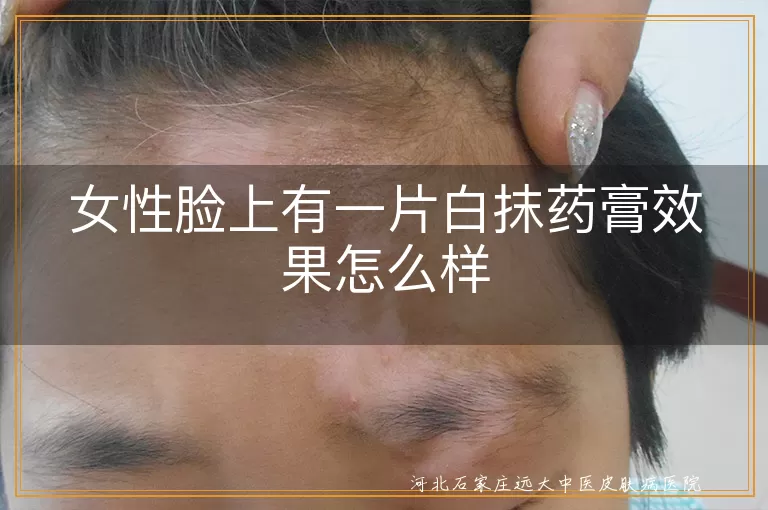 女性脸上有一片白抹药膏效果怎么样