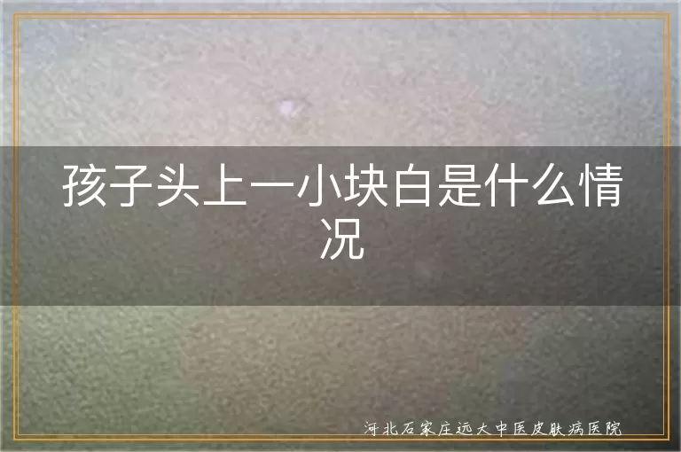 孩子头上一小块白是什么情况