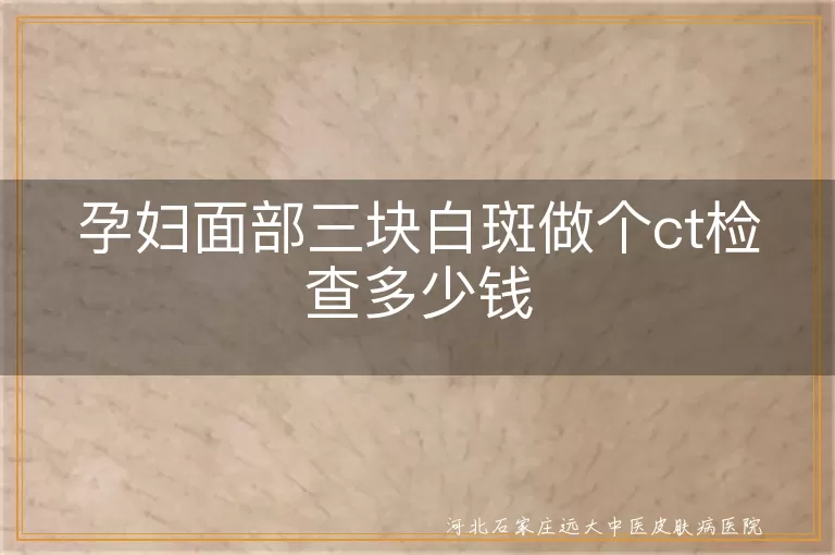 孕期面现三块白斑照CT费用,孕妇面部白斑CT检查价格多少,白癜风孕妇面部CT检查多少钱
