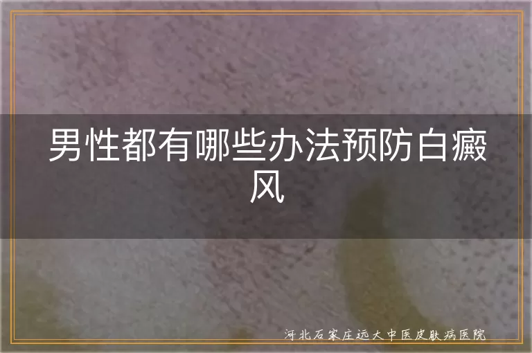 男性如何预防白癜风扩散,男士远离皮肤白斑的实用策略,青壮年白癜风早防早治要点
