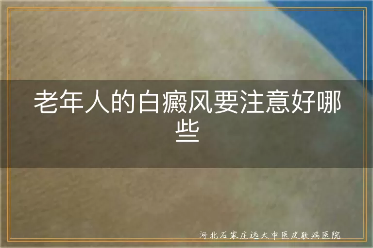 老年人白癜风日常护理要点,白斑患者晚年生活指南,老年白斑防扩散注意