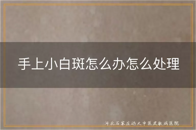 手上小白斑是不是早期白癜风,手部小白斑怎么判断是不是白癜风,手部小白斑怎么处理防止扩散