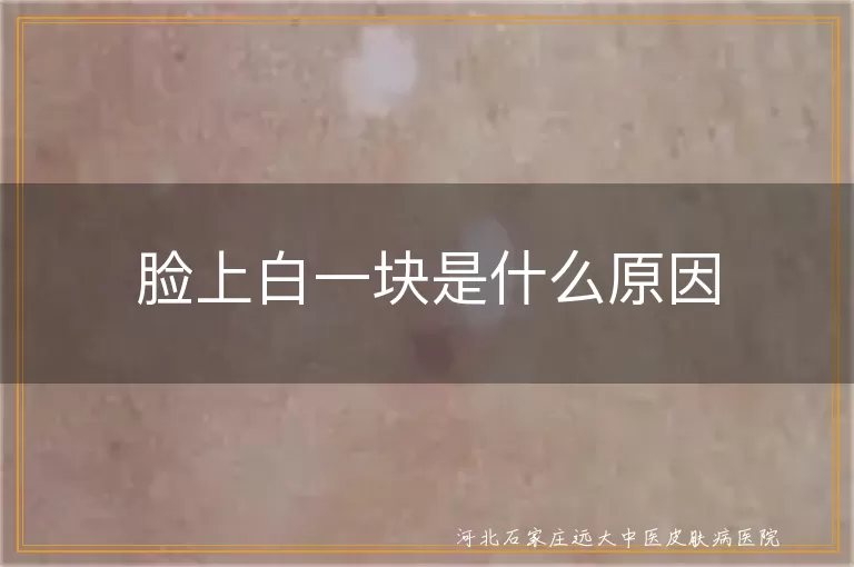 脸上白一块是什么原因