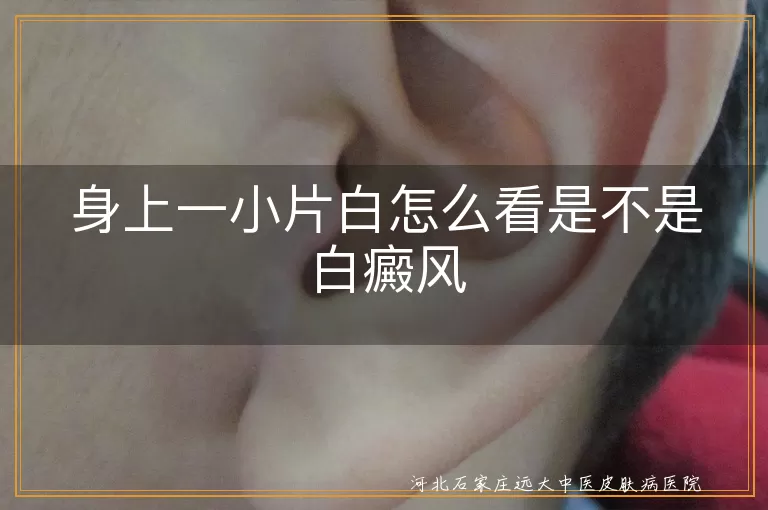 皮肤出现白斑是不是白癜风,白癜风早期白斑鉴别方法,白癜风白斑初期症状图片