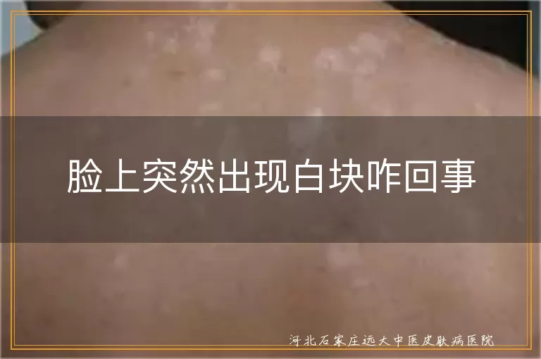 脸上突然出现白块咋回事