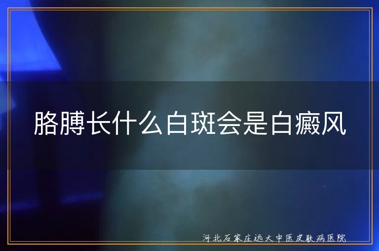 胳膊白癜风白斑特征,白癜风初期胳膊表现,胳膊白斑是不是白癜风