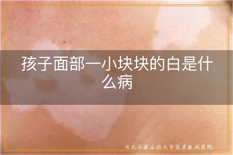 孩子面部白癜风初期表现,儿童白斑扩散信号,宝宝脸上白癜风鉴别