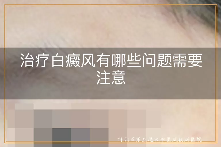 治疗白癜风有哪些问题需要注意