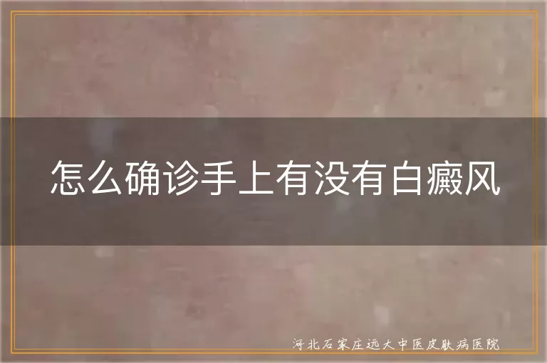 手上白斑是不是白癜风,如何确认手部白癜风,手部白斑诊断方法