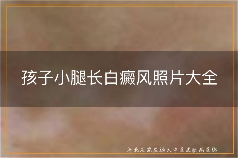 儿童小腿白癜风图集,孩子腿上白斑实拍,小儿白癜风腿部症状