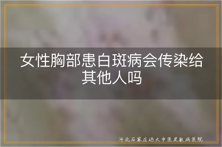 `女性胸部白癜风会传染吗,胸部白斑是否具有传染性,白癜风属于传染病吗`