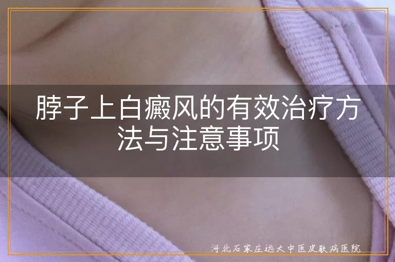 颈部白癜风治疗,脖子白斑护理,白癜风注意事项