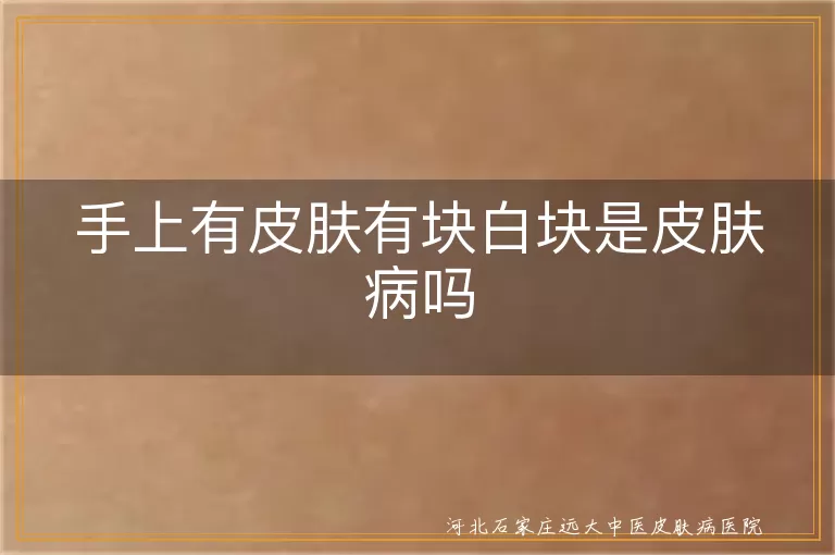 手上有皮肤有块白块是皮肤病吗