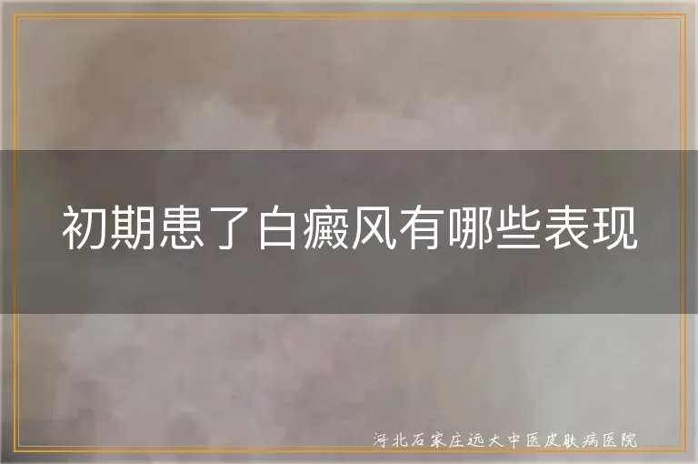 初期患了白癜风有哪些表现
