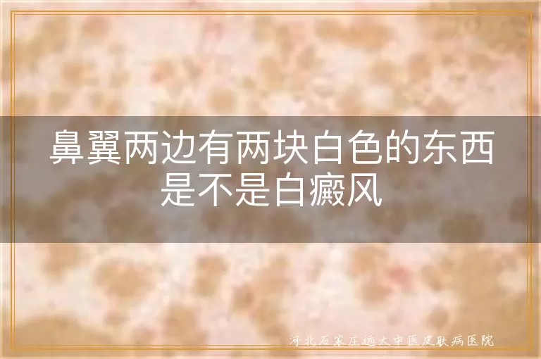 鼻翼两边有两块白色的东西是不是白癜风