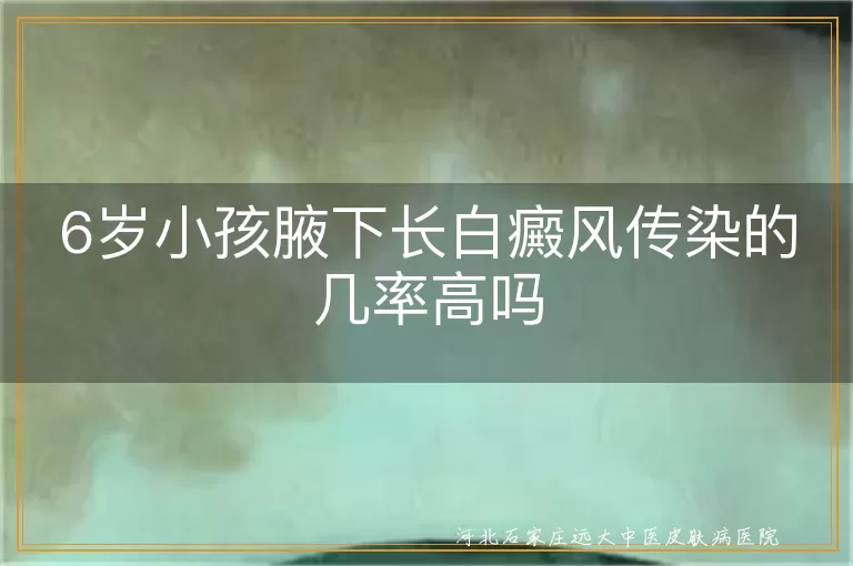 6岁小孩腋下长白癜风传染的几率高吗