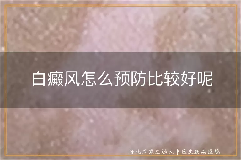 白癜风日常预防措施,白斑疾病科学防护,白癜风预防方法有哪些