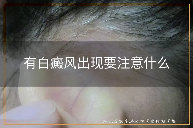 `白癜风初期需要注意什么,发现白斑后应如何处理,白癜风患者日常注意事项`