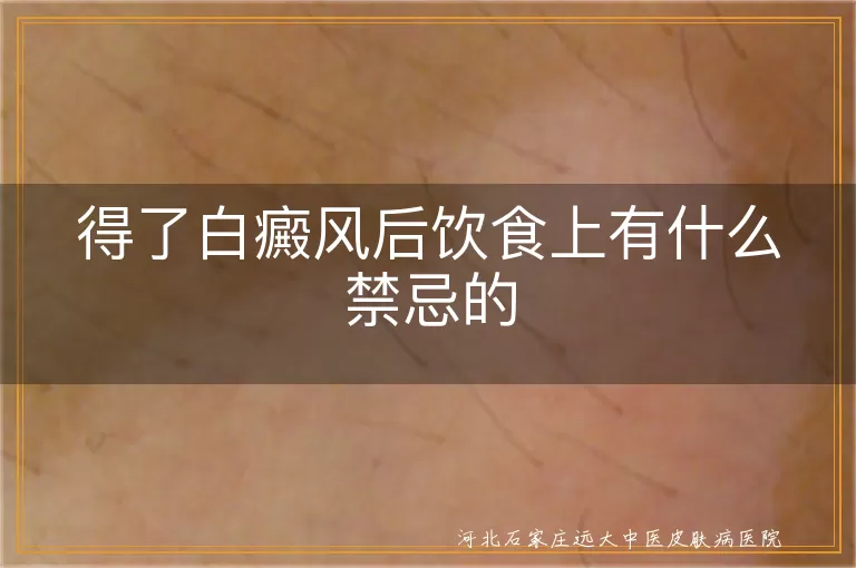 白癜风饮食禁忌有哪些,白斑患者不能吃什么食物,白癜风患者饮食注意事项