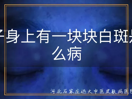 孩子身上出现白斑是白癜风吗,儿童皮肤白斑是什么原因,小孩身上长白斑怎么治疗
