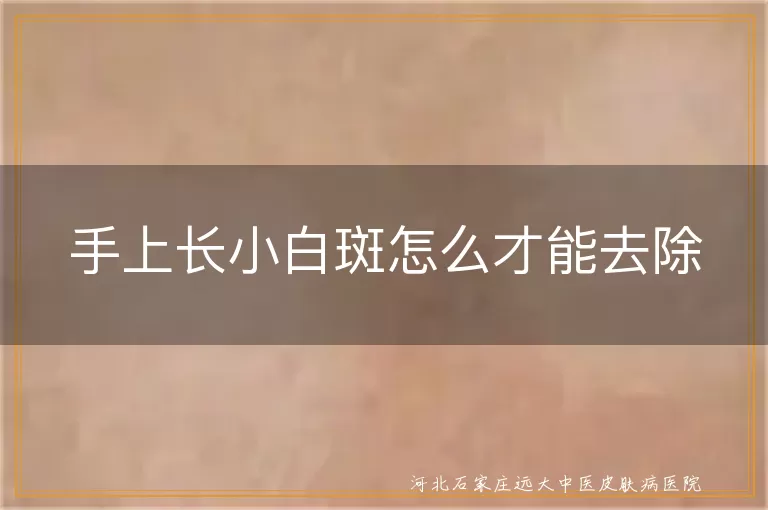 手部白癜风怎么治疗去除,手指白斑如何恢复治疗,手掌长白斑是什么原因