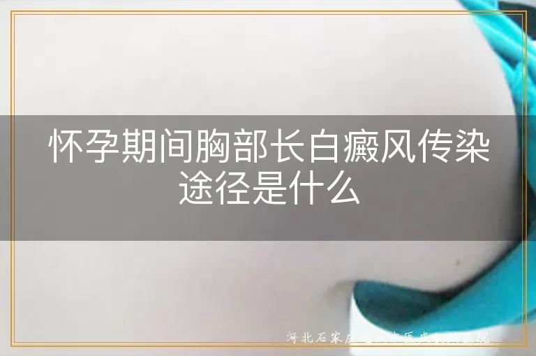 `孕妇胸部白斑是否存在传染性,妊娠期间白癜风会通过接触传播吗,孕期胸部皮肤白斑遗传几率分析`