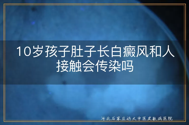 10岁孩子肚子长白癜风和人接触会传染吗