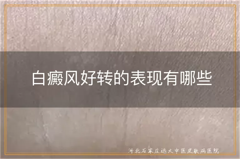 `白癜风患者好转迹象如何观察,白斑部位出现色素岛说明什么,白癜风治疗有效的症状表现`