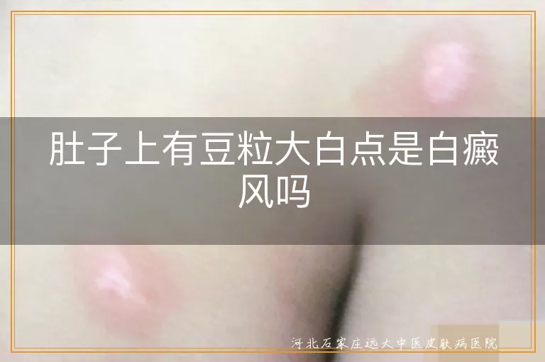 肚子上白色圆点是不是白癜风,腹部豆粒大白点白癜风判断,肚皮上小白点白癜风症状