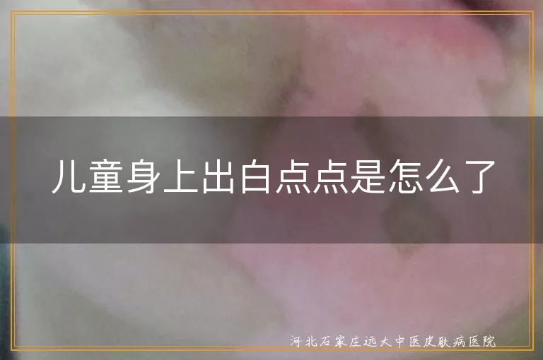 儿童身上长白点是不是白癜风,孩子身上出现白斑怎么回事,儿童皮肤有白点是白癜风吗