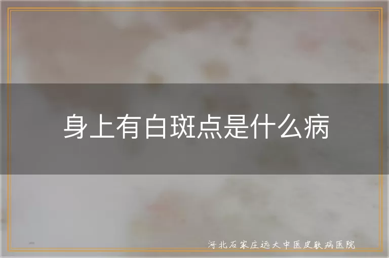 身上有白斑点是什么病,身上长白斑是白癜风吗,皮肤出现白斑的原因