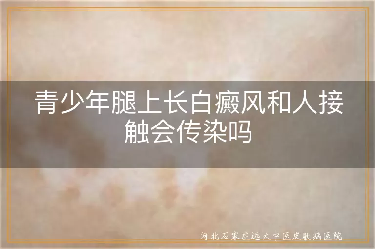 青少年腿上白斑会传染吗,腿上白癜风接触会传染吗,青少年白癜风传染不传染